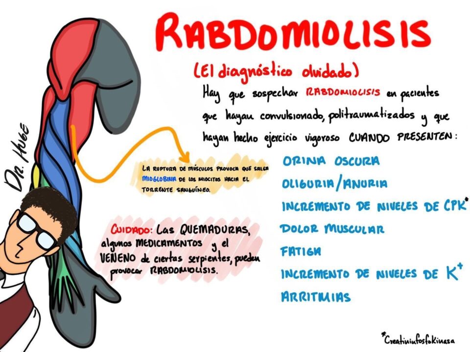 rabdomiolisis